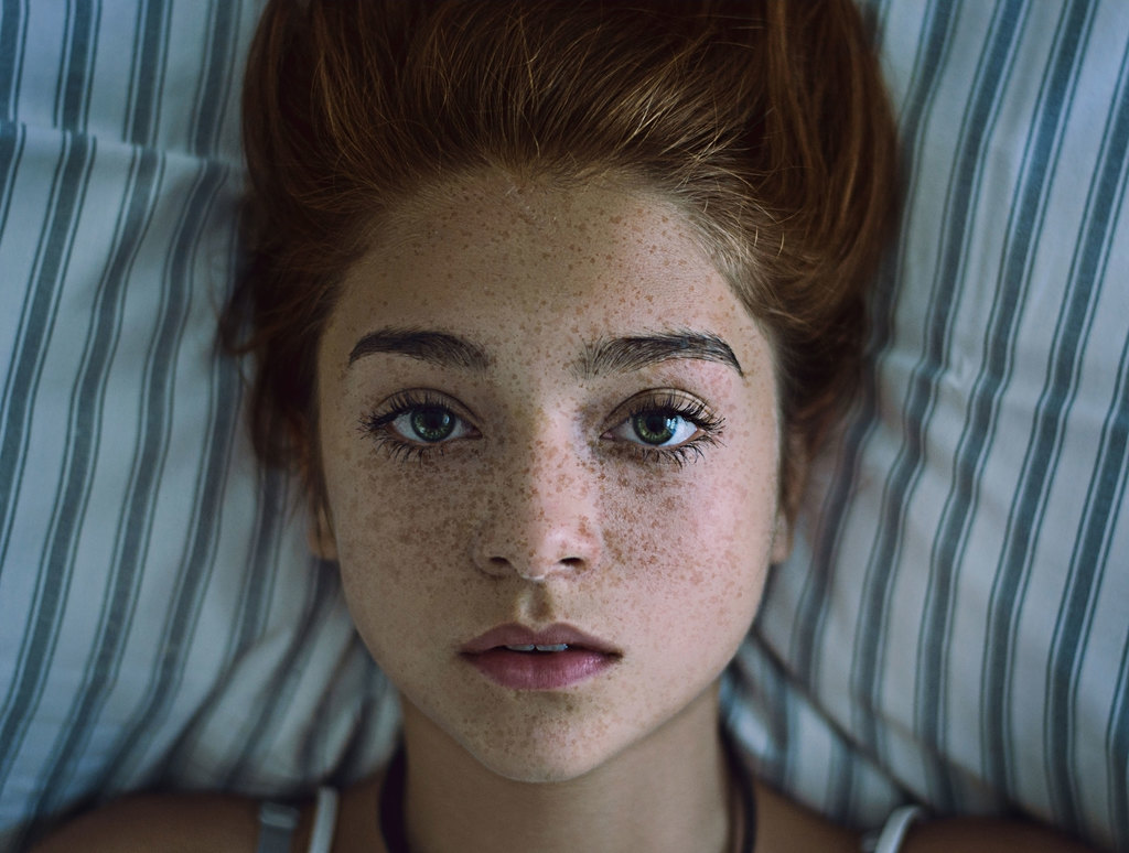 Girl face with freckles